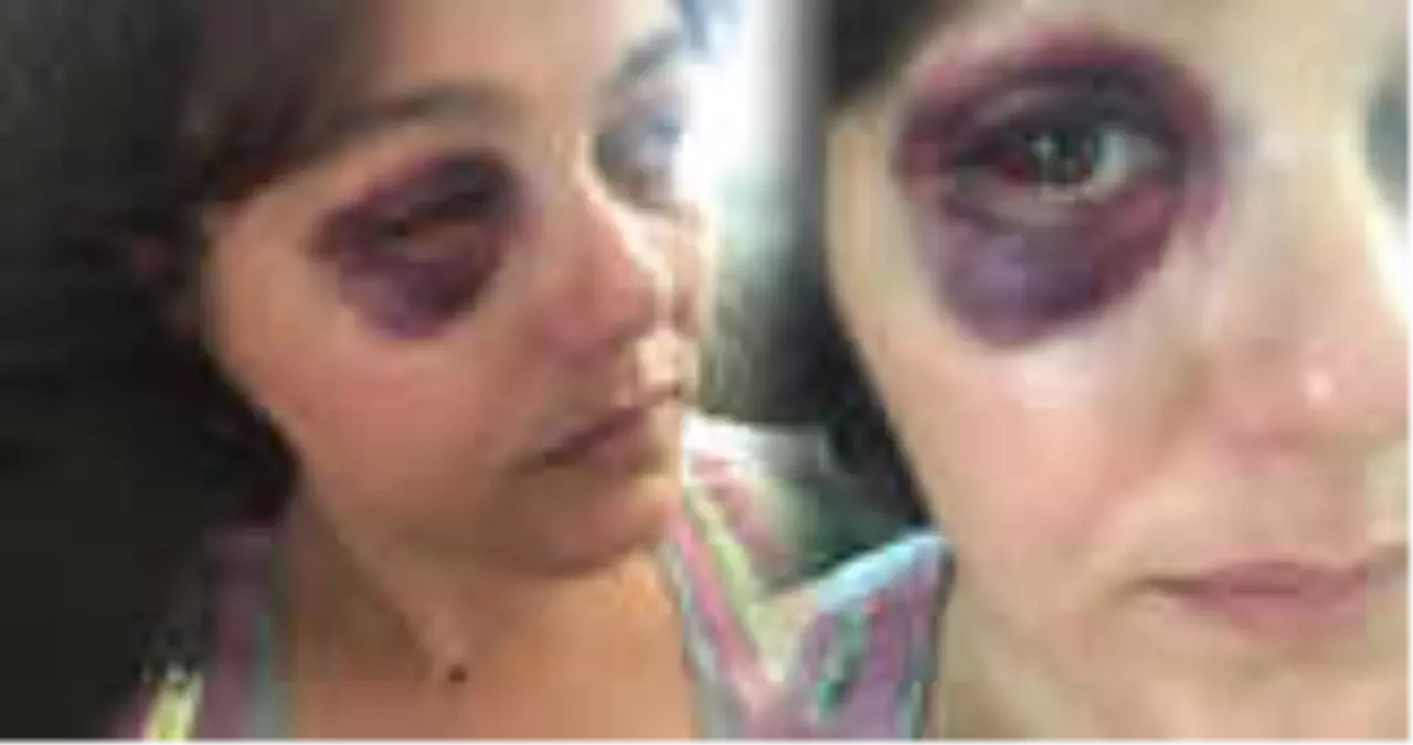 Kadıköy\'de Saldırgan, "Senin Havan Kime" Deyip Restoranda Yemek Yiyen Kadına Yumruk Attı