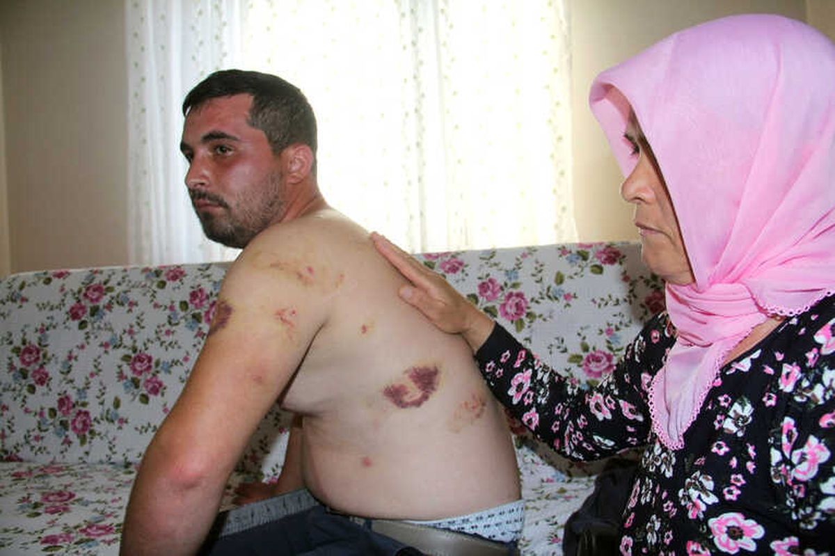 Sosyal Medyada Tanıştığı Kadın, Giresunlu Gencin Hayatını Kararttı