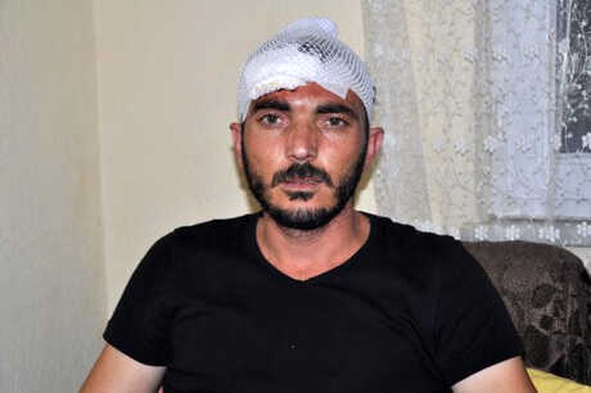 Polisin Dövüp, Ters Kelepçe Taktığı Olayda 3 Polis de Yaralanmış