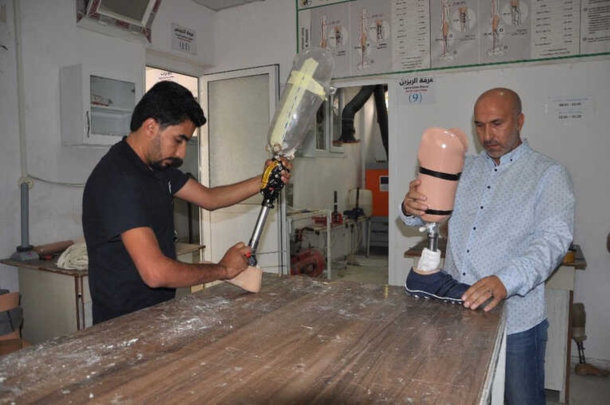 6 Bin 500 Suriyeliye Protez Takıldı