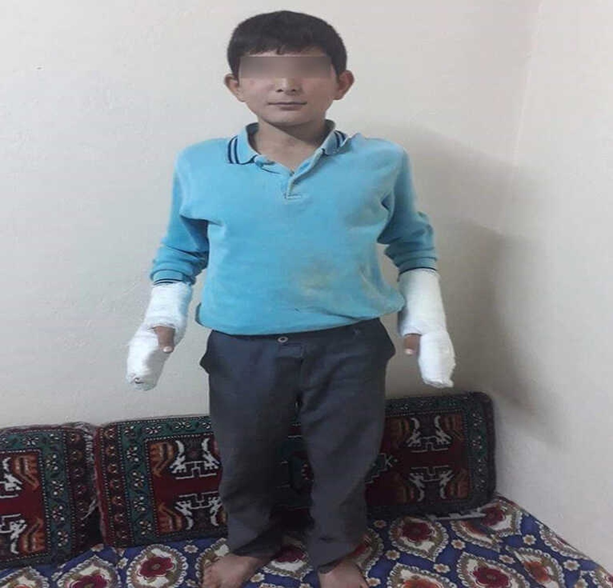 Öğrenciyi Bu Hale Getiren Okul Müdürü Görevden Uzaklaştırıldı