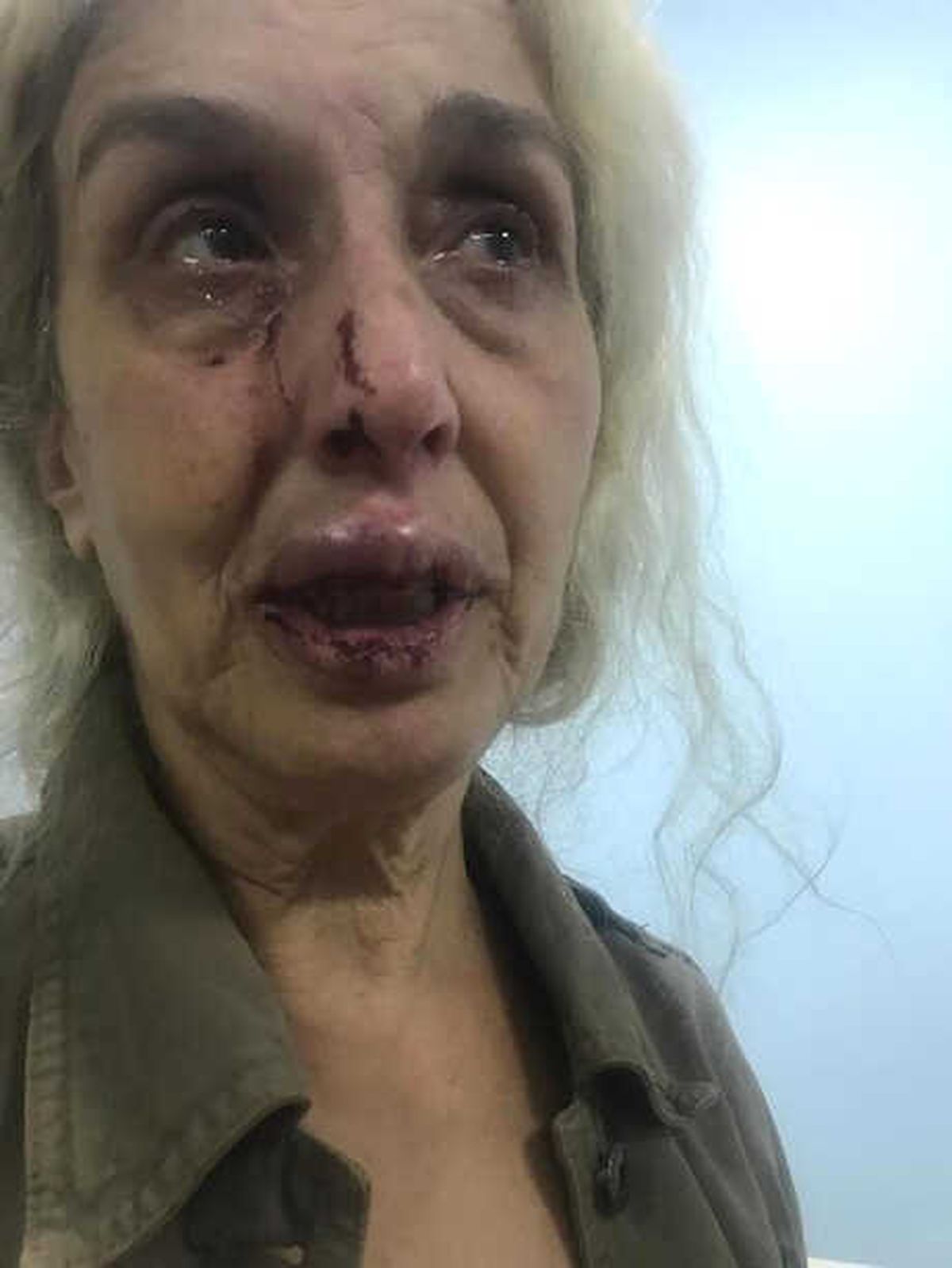Sokak Hayvanlarını Besliyor Diye Dövdüler İddiası