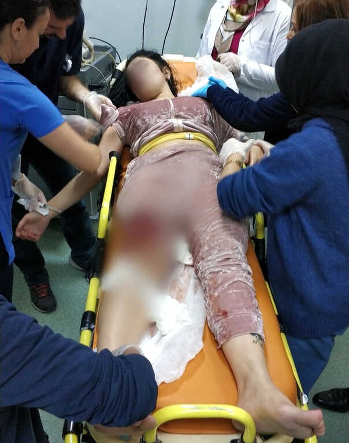 Ağabeyinin Silahlı Saldırısında Yaralandı