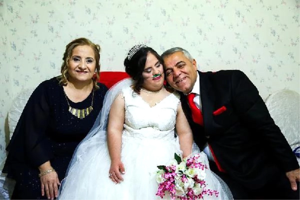 Down Sendromlu Hazal Yeni Yaşına Düğünle Girdi