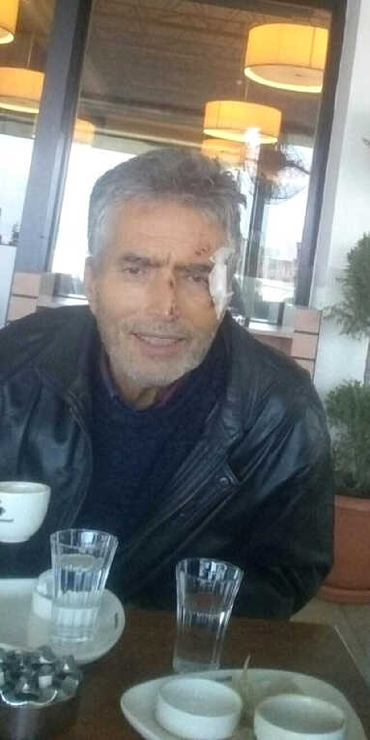 Kayıp Adam Vatandaşın Dikkati Sayesinde Bulundu