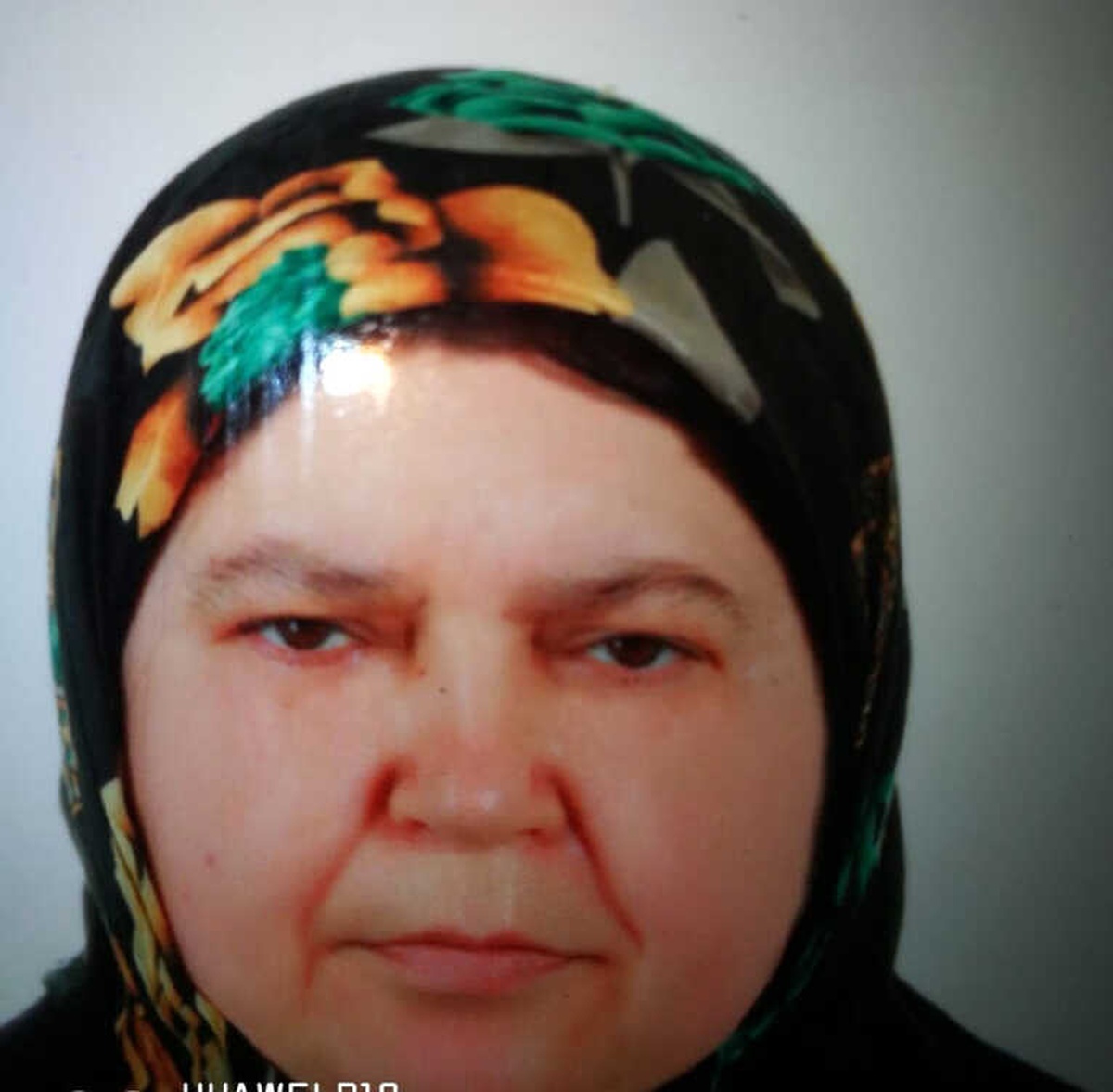 Yediği Lokum Soluk Borusuna Kaçan Kadın Hayatını Kaybetti