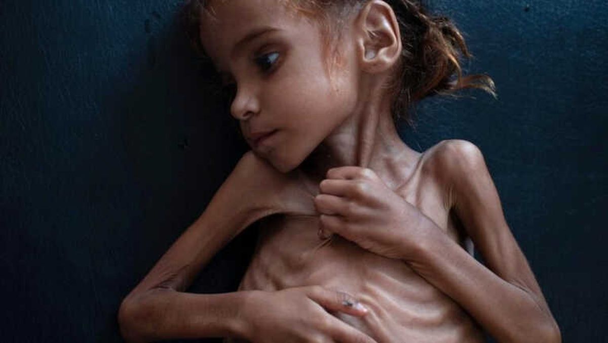 Yemen İçin Tek Yürek !