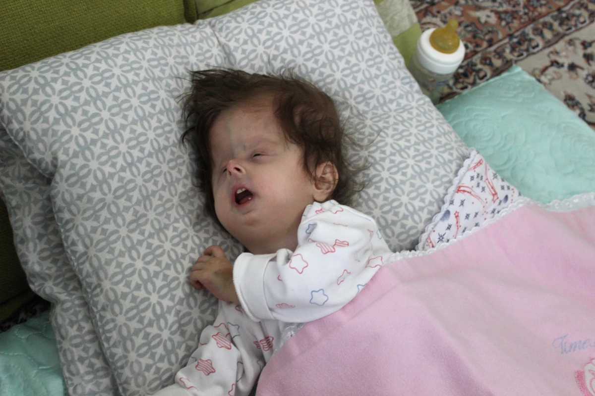 2 Yaşındaki Hatice, Hastalığı Nedeniyle 3 Aylık Bebek Gibi Görünüyor