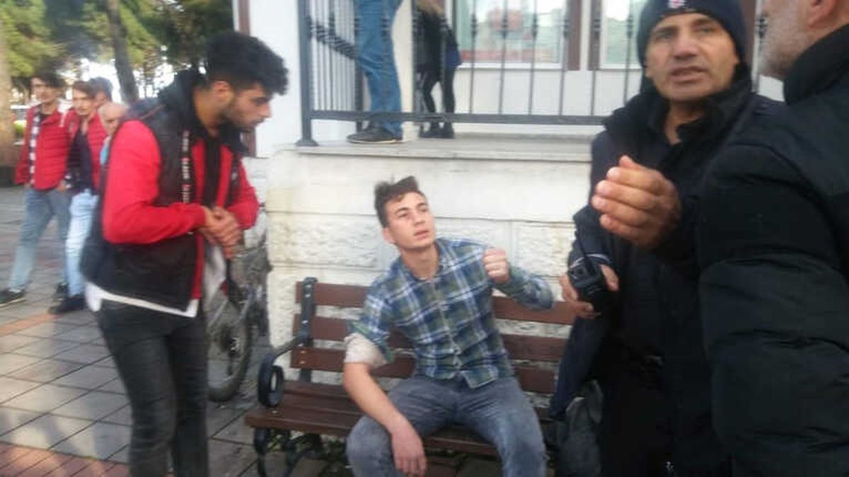 Sahibiyle Kavga Edeni Kolundan Isırdı