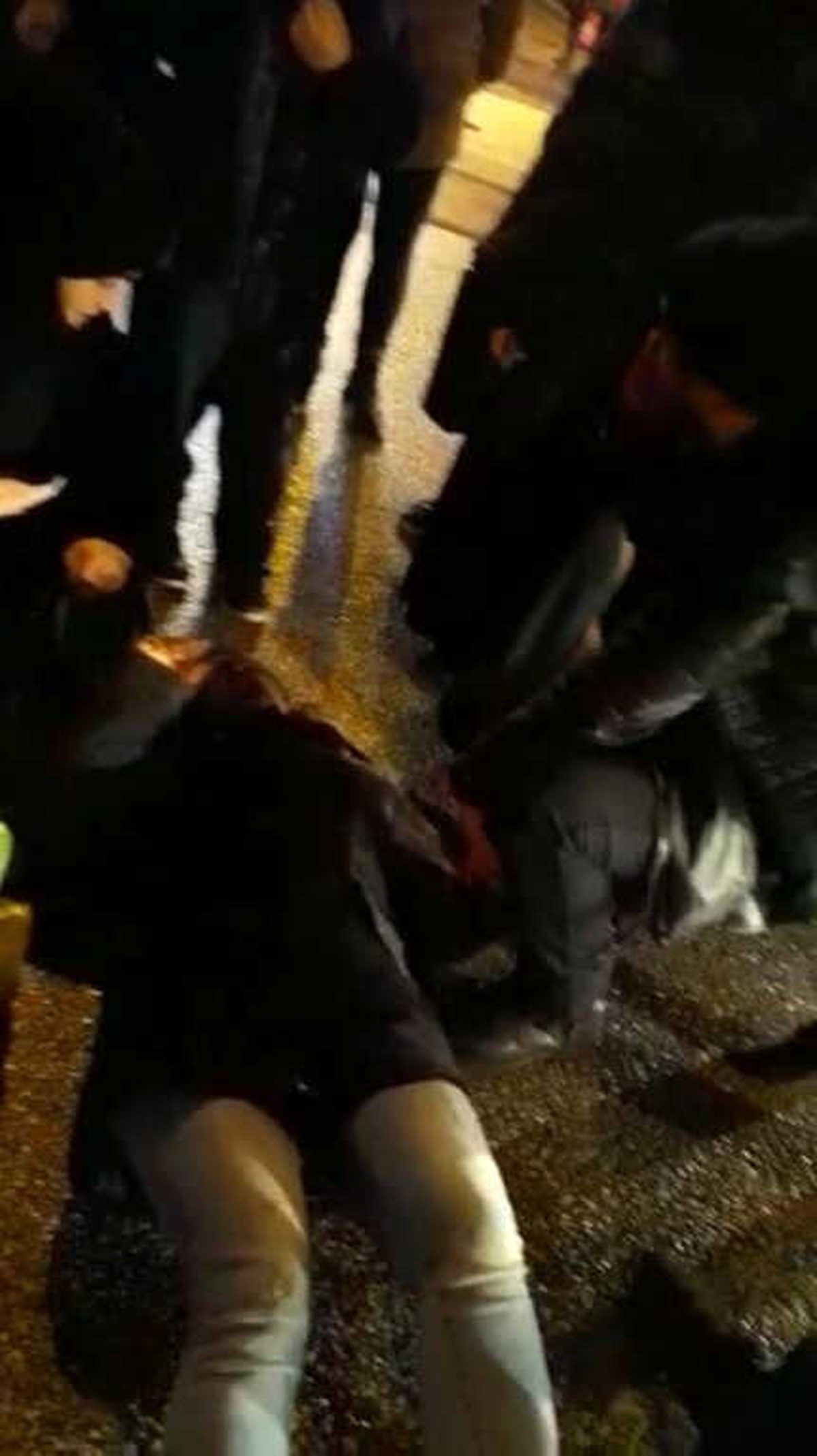 Otomobilin Çarpıp Kaçtığı Genç Kadın Yaralandı