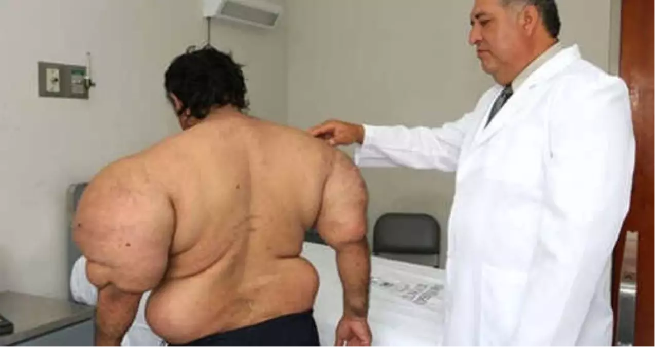 Açık Denizde Vurgun Yiyen Dalgıç, Temel Reis\'e Benzedi