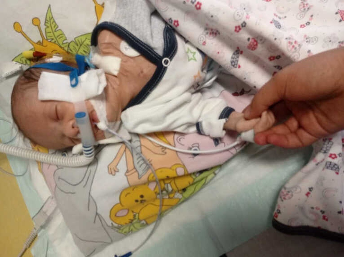 Mete Bebek Hayata Tutunmak İçin Yardım Elini Bekliyor
