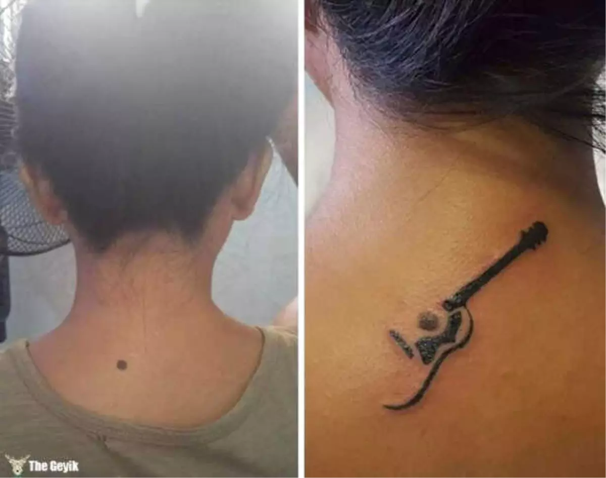 Doğum Lekesini Kreatif Bir Dövmeyle Kapatmış 15 Kişi