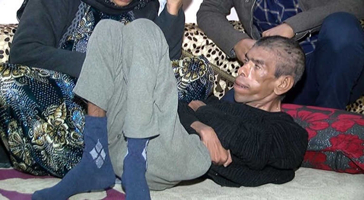 35 Yaşındaki Engelli Oğluna Bebek Gibi Bakıyor