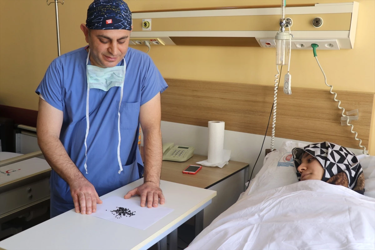 Karın Ağrısı ile Hastaneye Gitti Safra Kesesinden 200 Taş Çıktı
