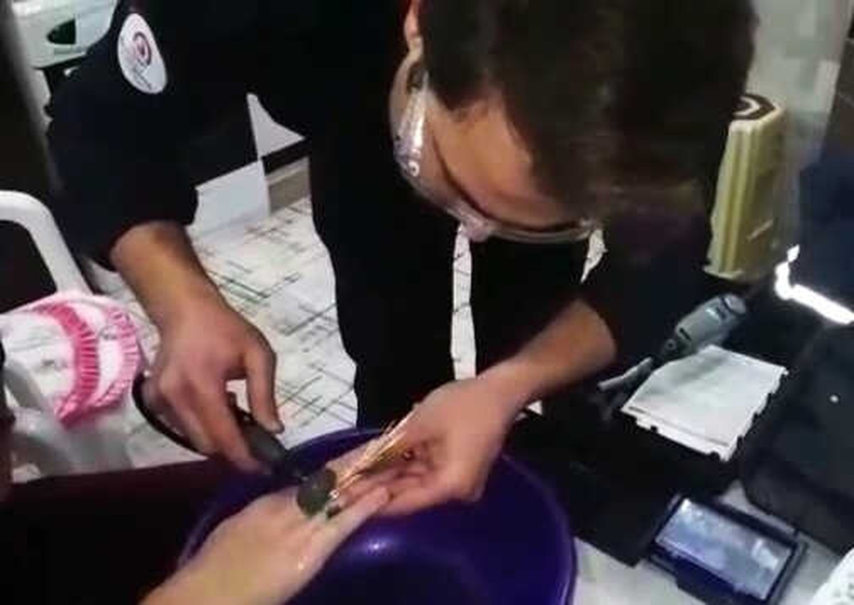 İtfaiyeden Yüzük Çıkarma Operasyonu
