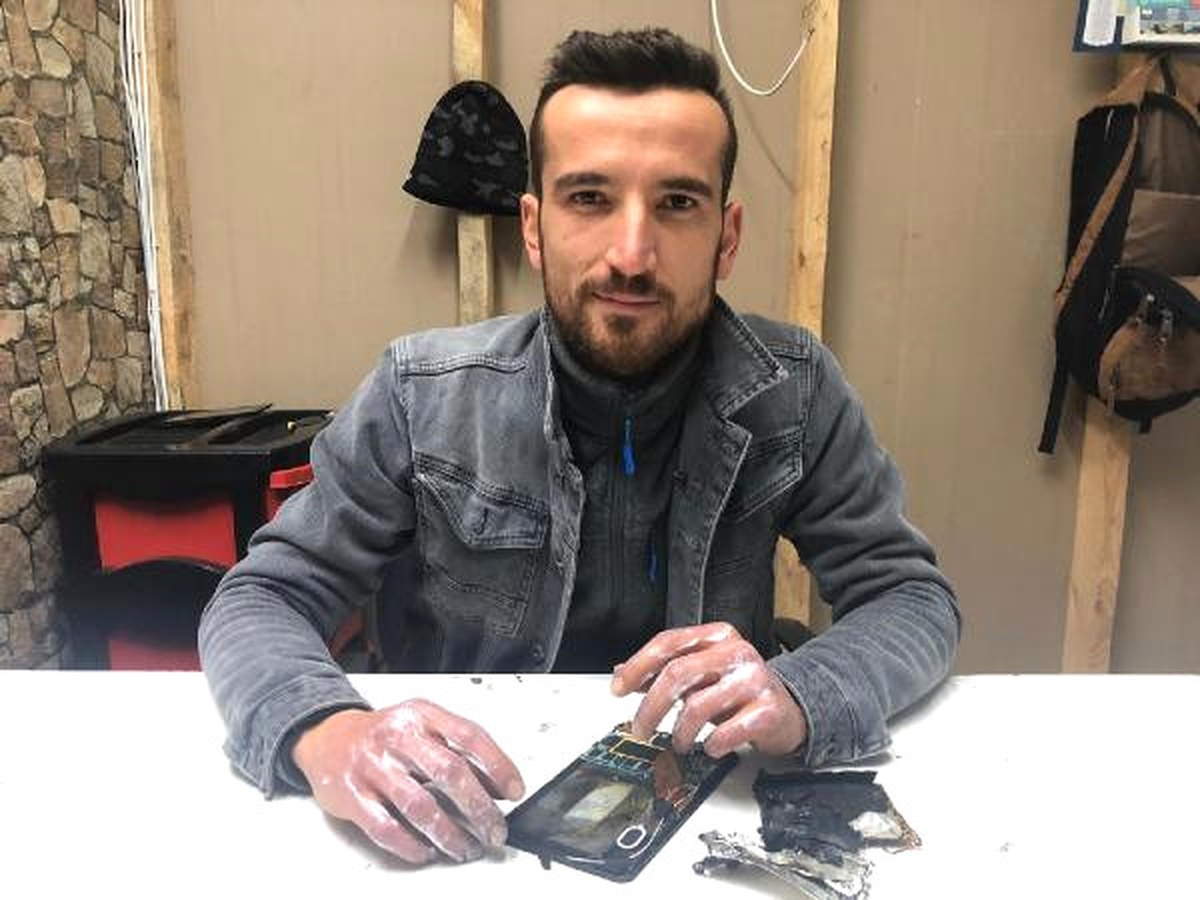 Tamir Ettiği Tablet Patladı, İki Eli ve Kulağı Yandı