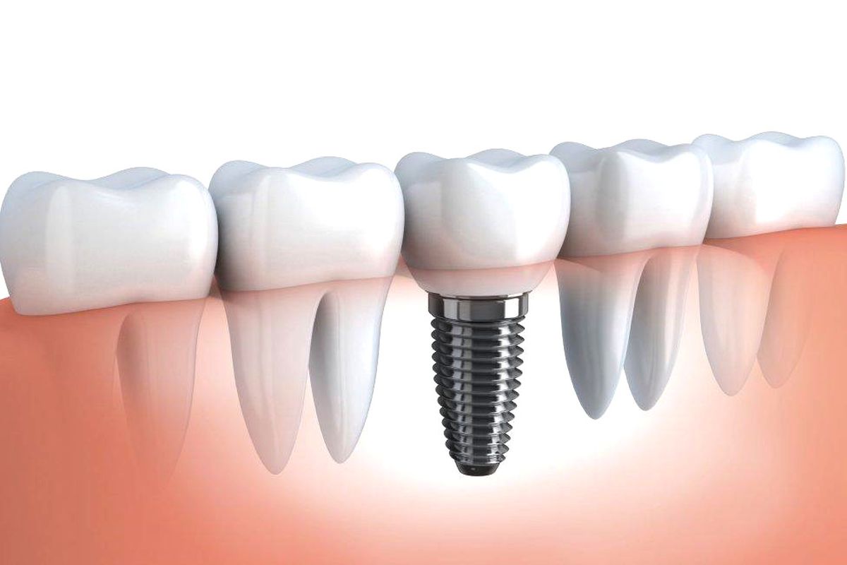 AKM\'de Dental Sempozyumu Gerçekleştirilecek