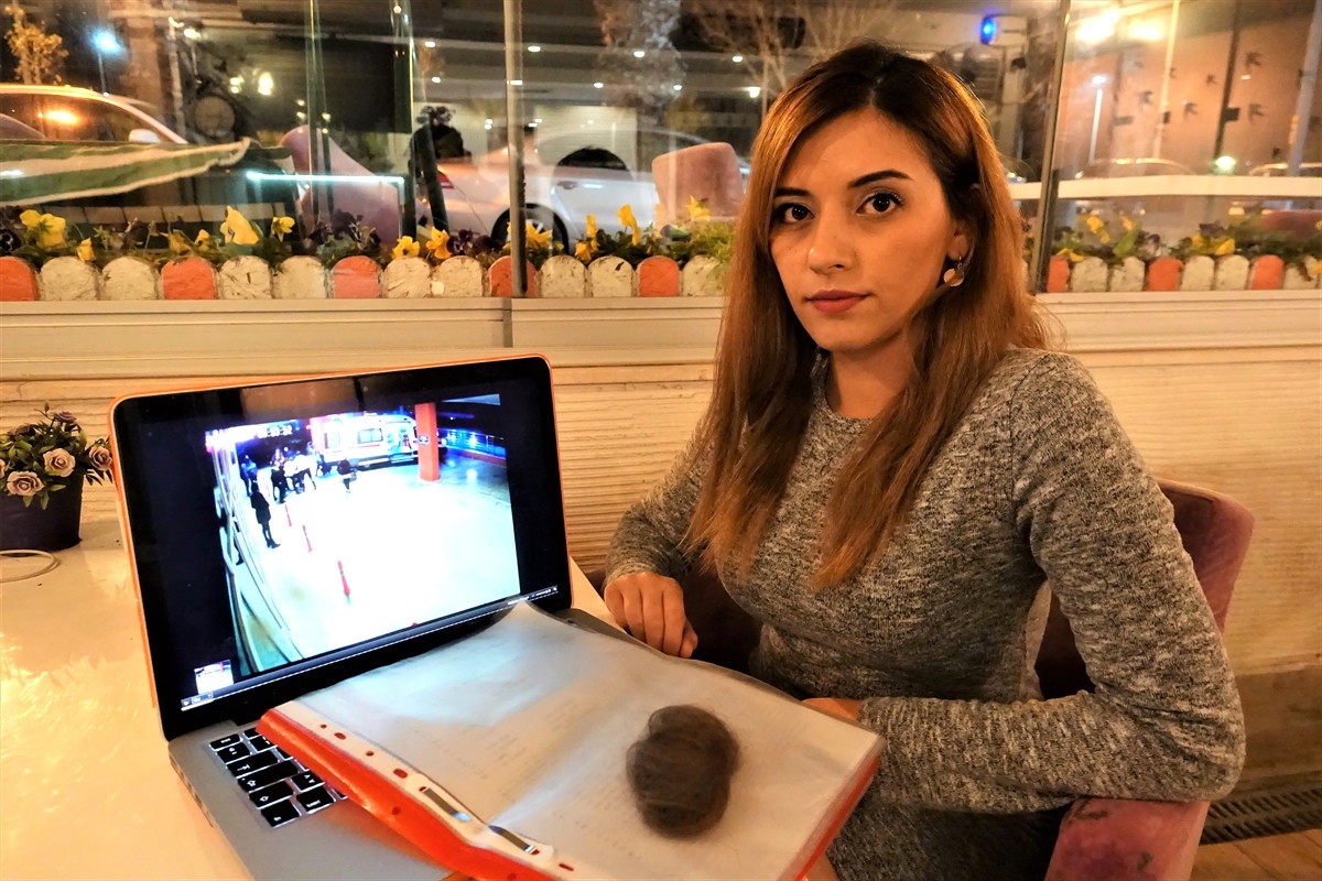 Acil Servis Görevlisi Koparılan Saçlarını "Delil" Olarak Saklıyor