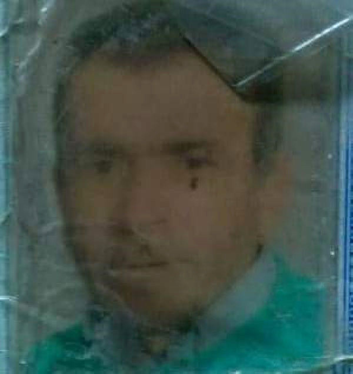 5\'inci Kat Penceresinden Bakarken Düşüp, Öldü