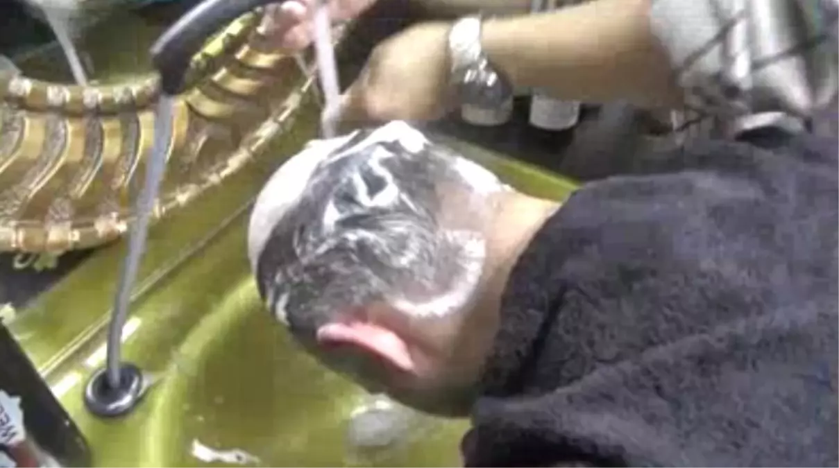 3-4 Saatte Üstelik Garantili Yeni Saçlara Kavuşmak Artık Mümkün