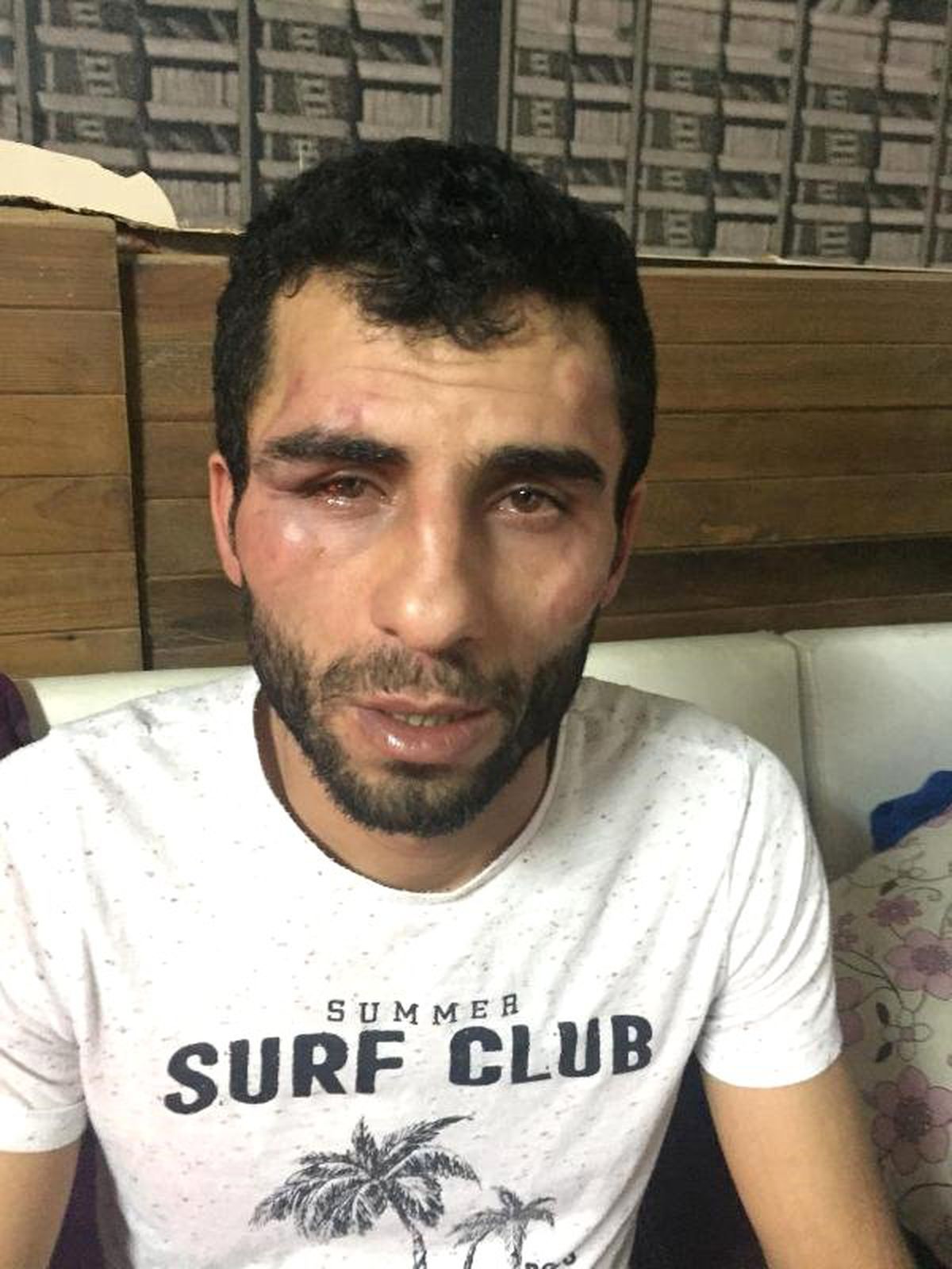 Zabıta Ekiplerinden, Seyyar Satıcıya Şiddet (2)