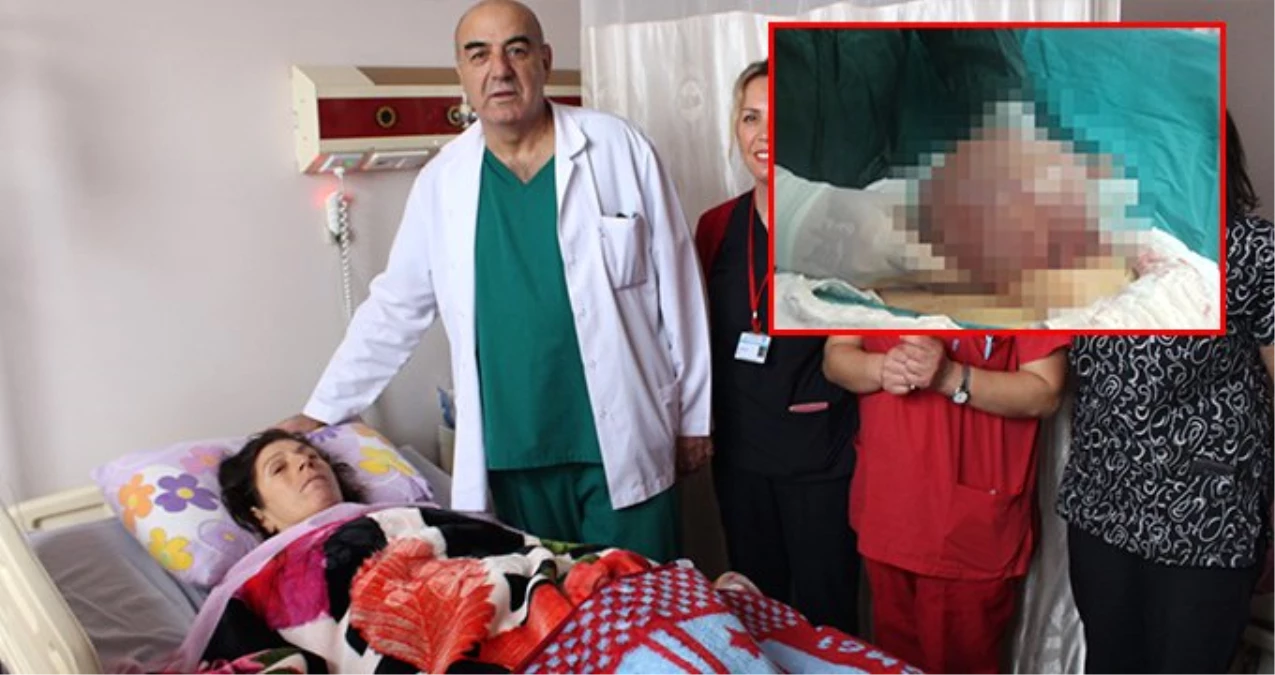 Aşırı Kilo Problemi Nedeniyle Hastaneye Giden Kadının Midesinden 7 Kilo Ur Çıktı