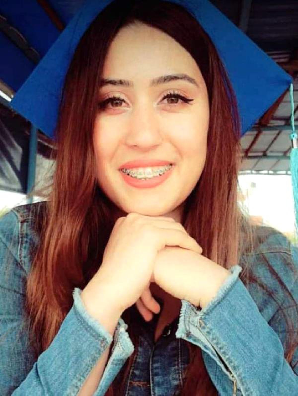 Üniversiteli Leyla, Burun Ameliyatından Sonra Komaya Girdi