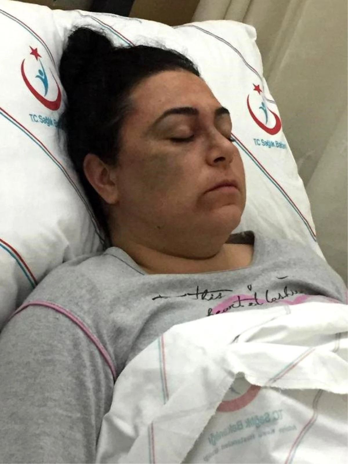 3 Kadını Hastanelik Eden Saldırgan, "Kendimi Savundum" Deyip Serbest Kaldı