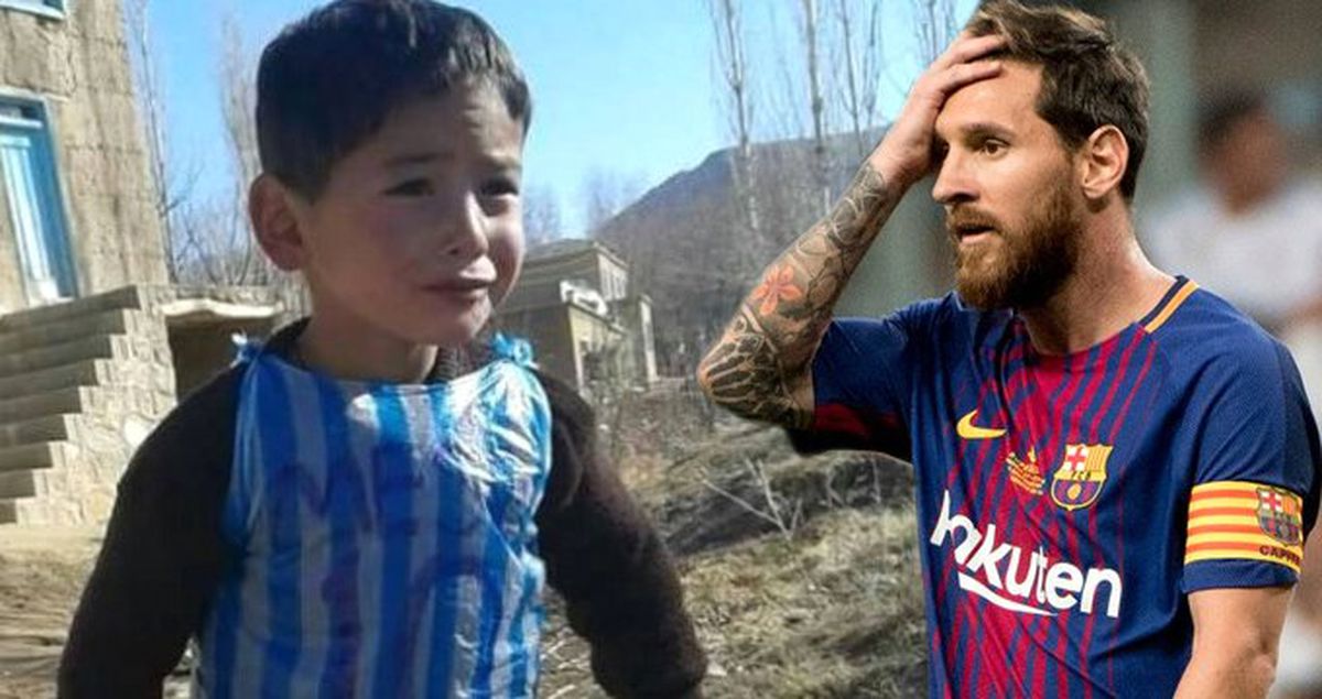 Poşet Formalı Küçük Messi\'nin Annesi Konuştu: Her Gün Ölüm Korkusuyla Yaşıyoruz