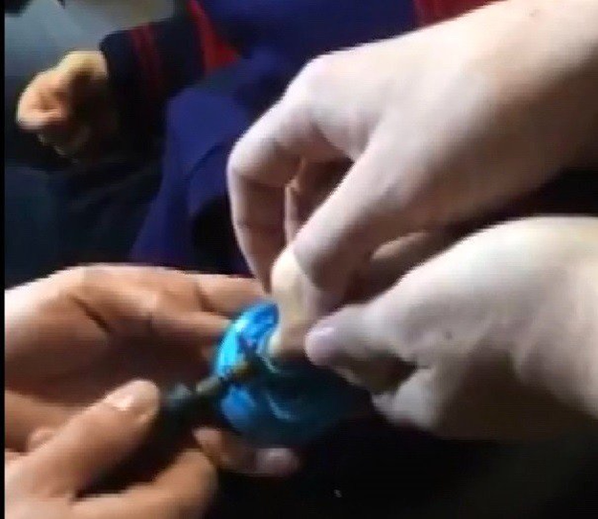 Öğrencinin Parmağını Sıkıştırdığı Su Termosu Kapağı Kesilerek Çıkartıldı