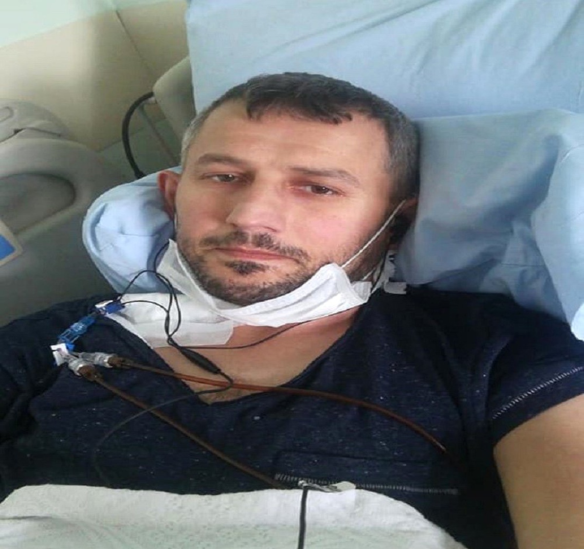 Abdulkadir Parmak\'ın Kanser Hastası Kuzeni Dua İstiyor