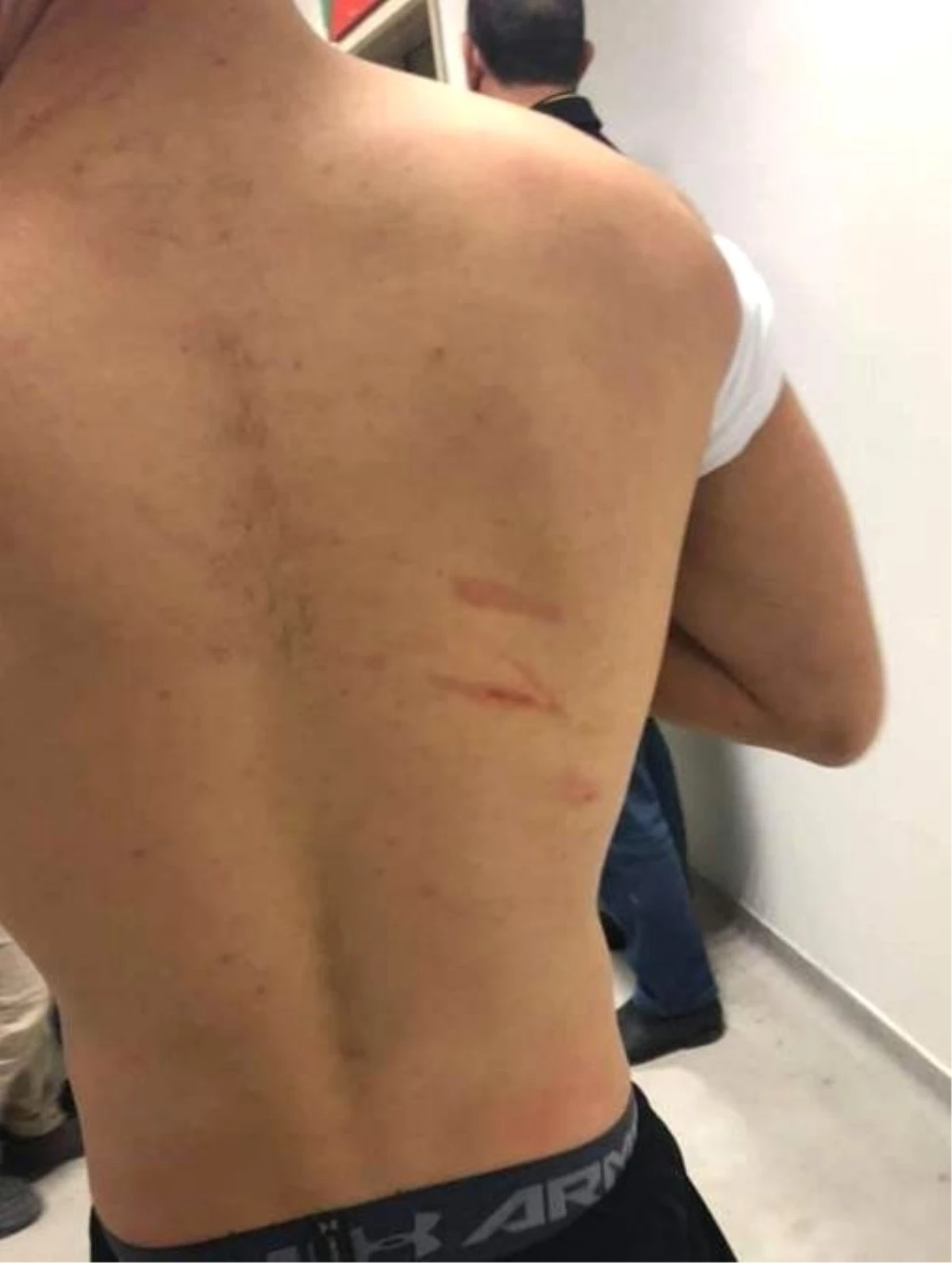 Amedspor - Sakaryaspor Maçında Şok İddia: "Futbolcuları Jiletle Yaraladılar"
