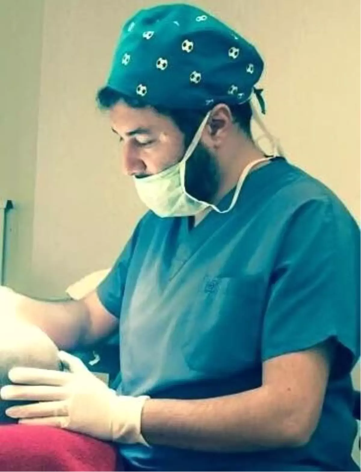 Saç Ekiminde Kök ve Deri Analizi