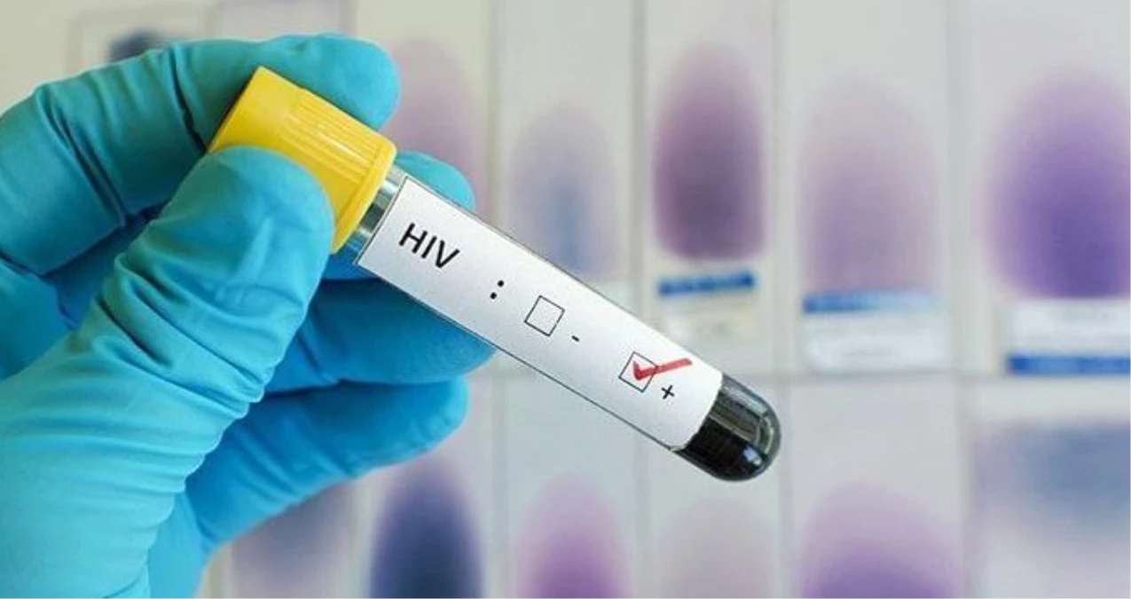 Kök Hücre Tedavisi Sonrası HIV Virüslü Hastada İyileşme Tespit Edildi