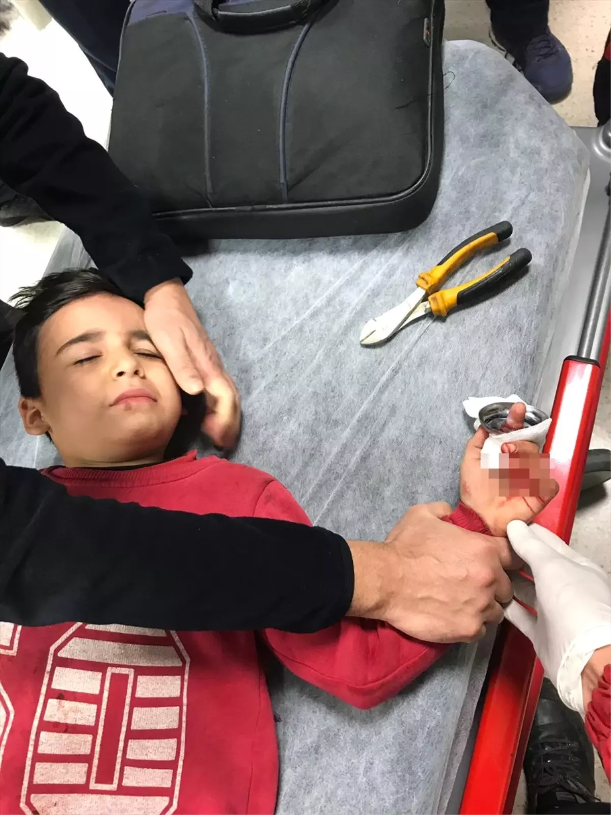 Çocuğun Parmağına Sıkışan Metal Halka Acil Serviste Çıkarıldı