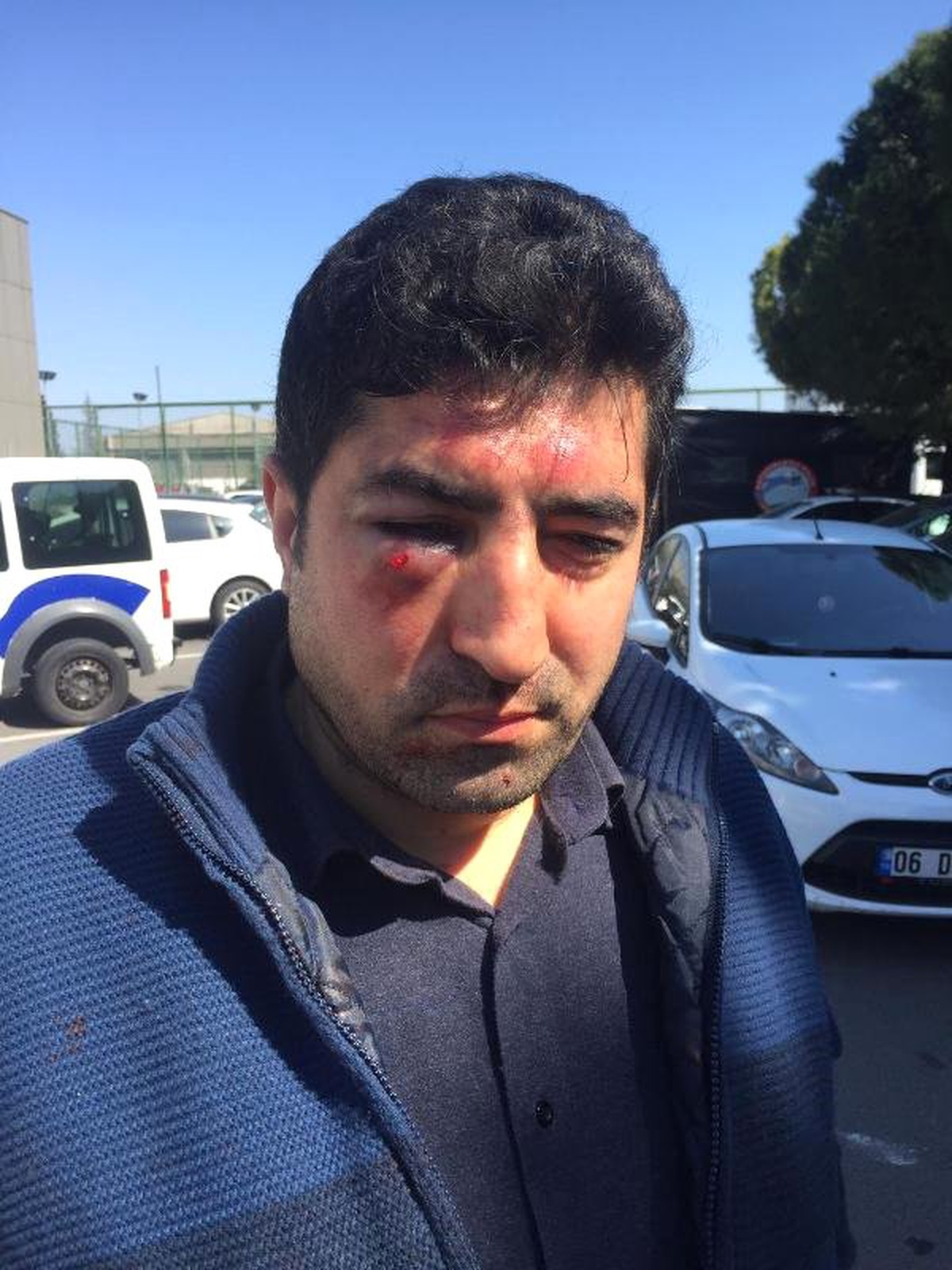 Senagalli Yolcunun Şikayetçi Olduğu Taksiciye Meslektaşlarından Dayak
