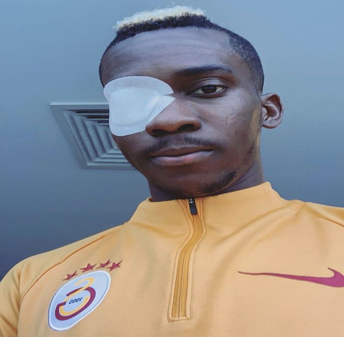 Henry Onyekuru Gözünün Son Halini Paylaştı