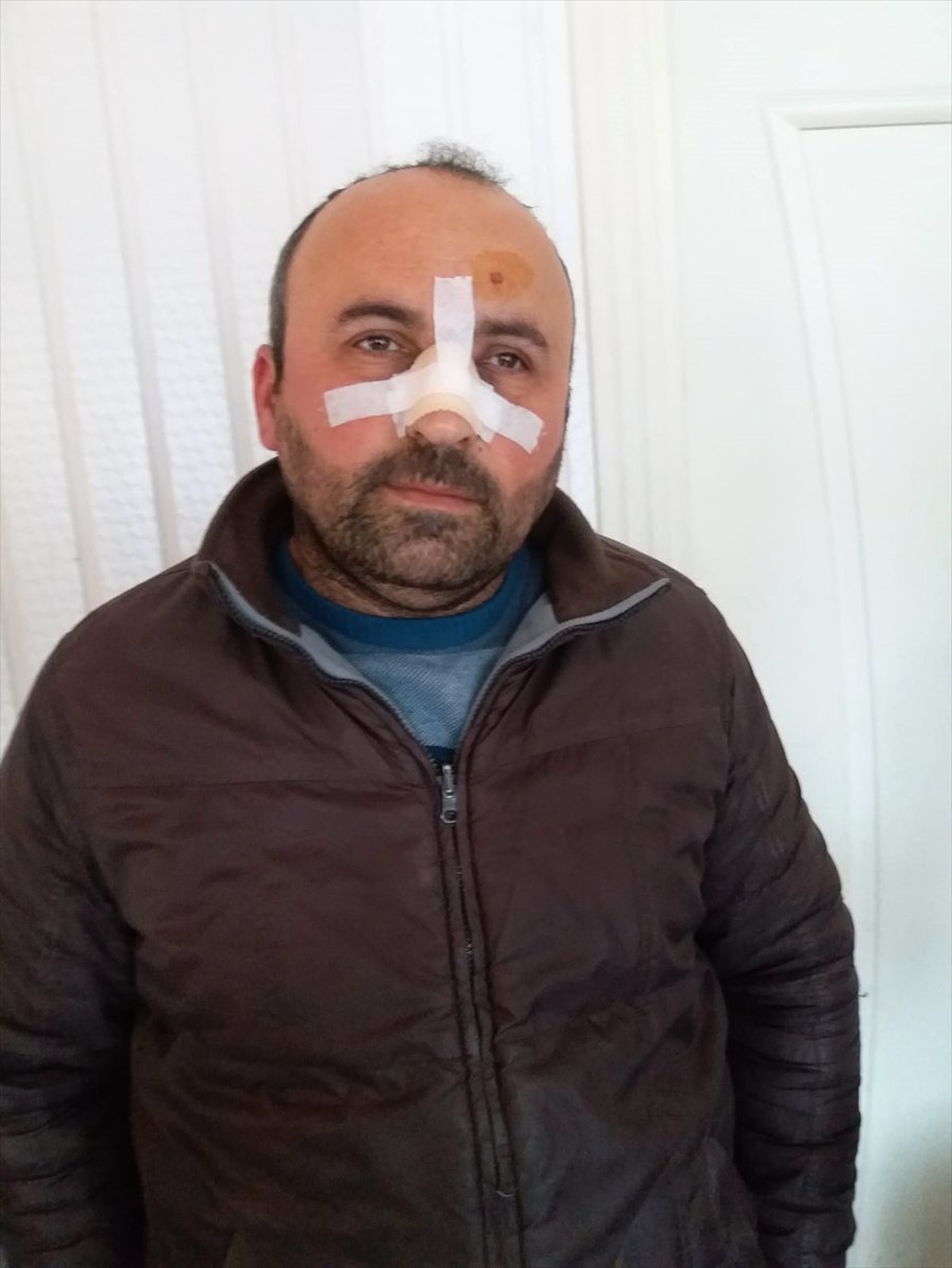 Fırıncının "Ucuz Ekmek Sattı" Diye Darbedildiği İddiası