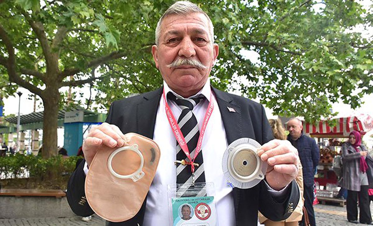 Kolon Kanseri Hastalarının \'Torba Parası\' Sıkıntısı