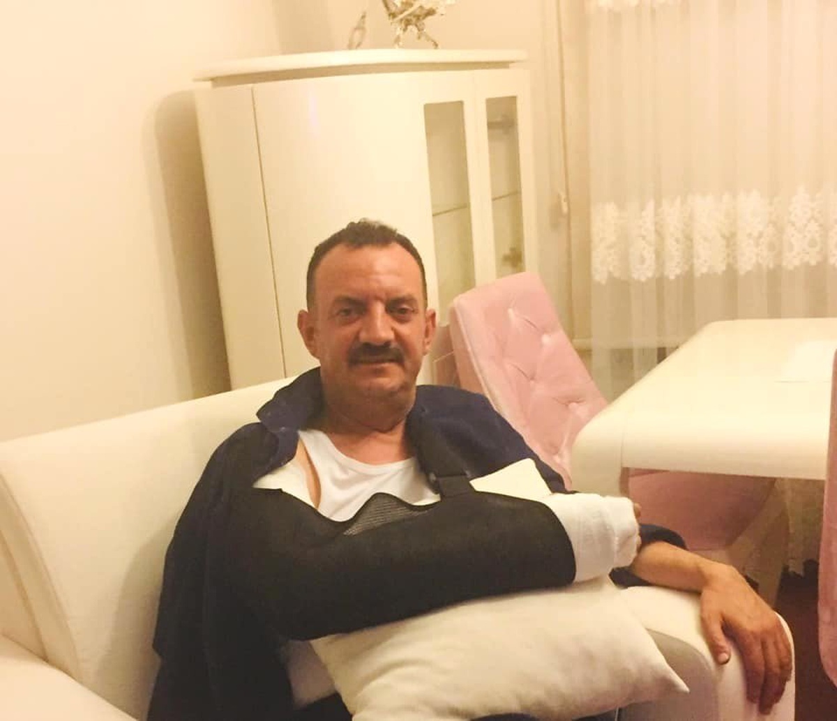 Başkan Yardımcısı Top Oynarken Kolunu Kırdı