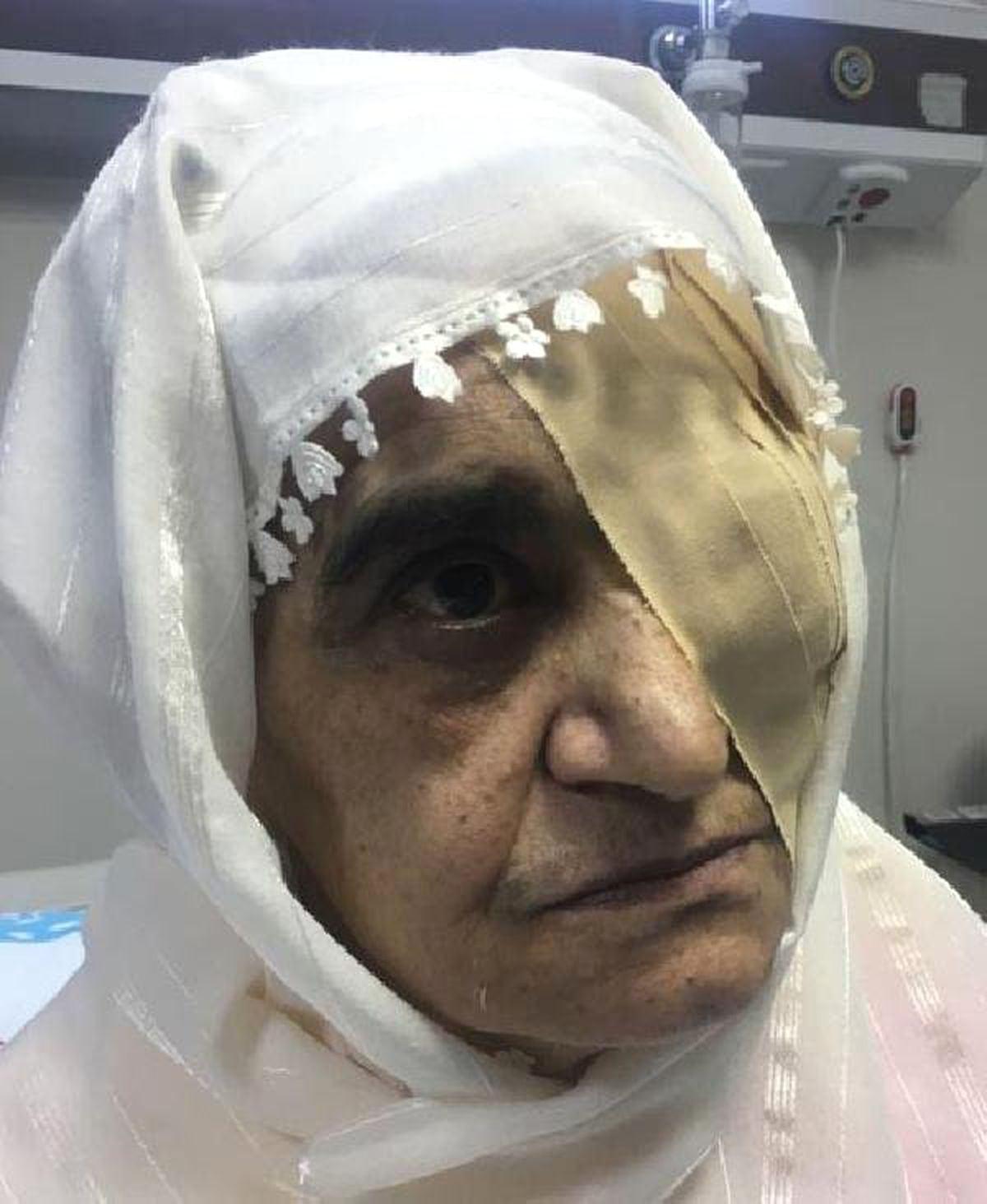 Kör Eden Katarakt Ameliyatları İçin 570 Bin Liralık Dava