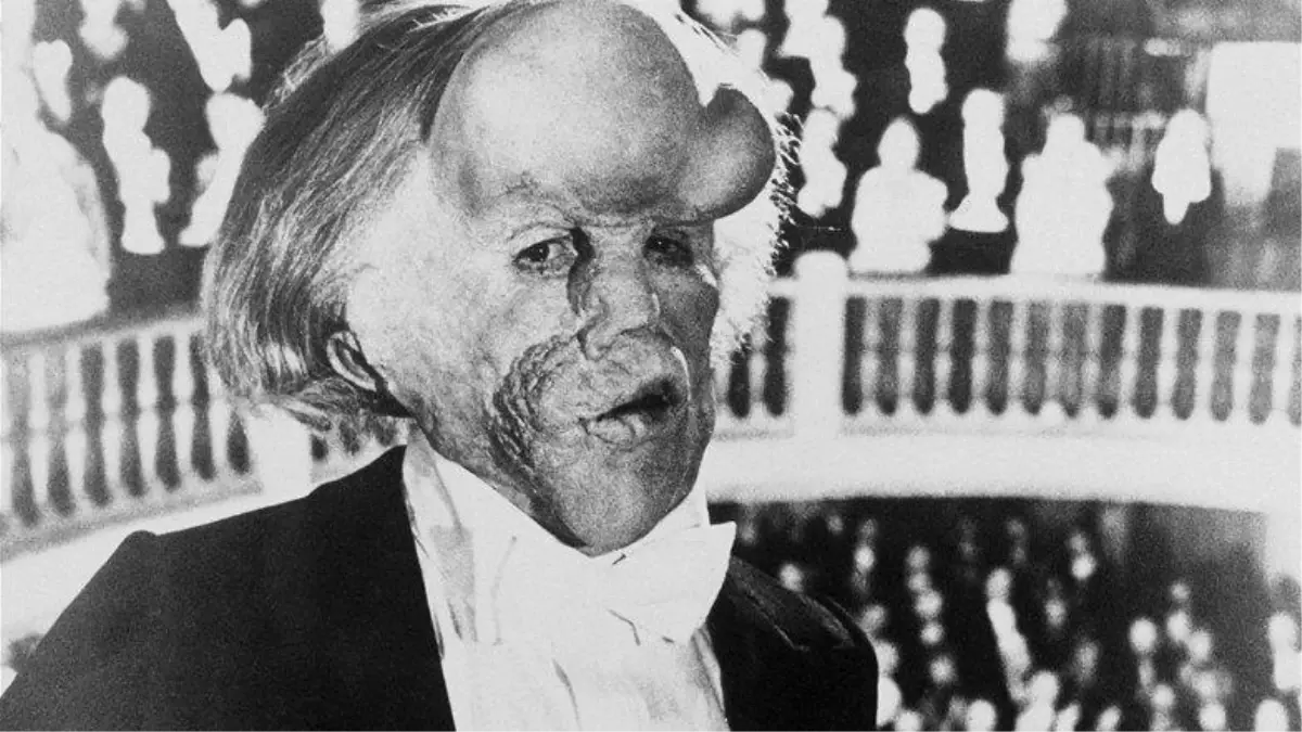 Filmlere Konu Olan \'Fil Adam\'ın Mezarı, Öldükten 130 Yıl Sonra Bulundu