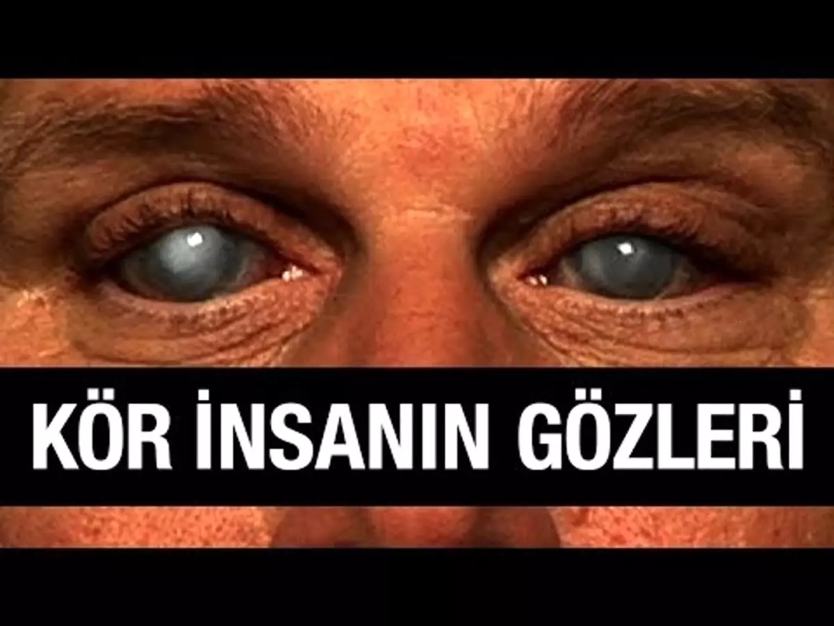 Körler Gözünü Açabilir Mi?