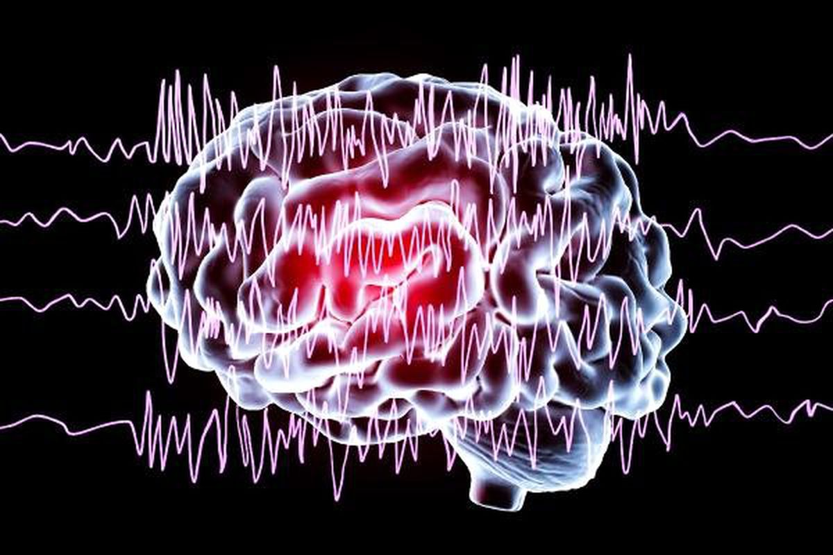 3 Epilepsi Hastasından 2\'si İş Bulmakta Zorlanıyor
