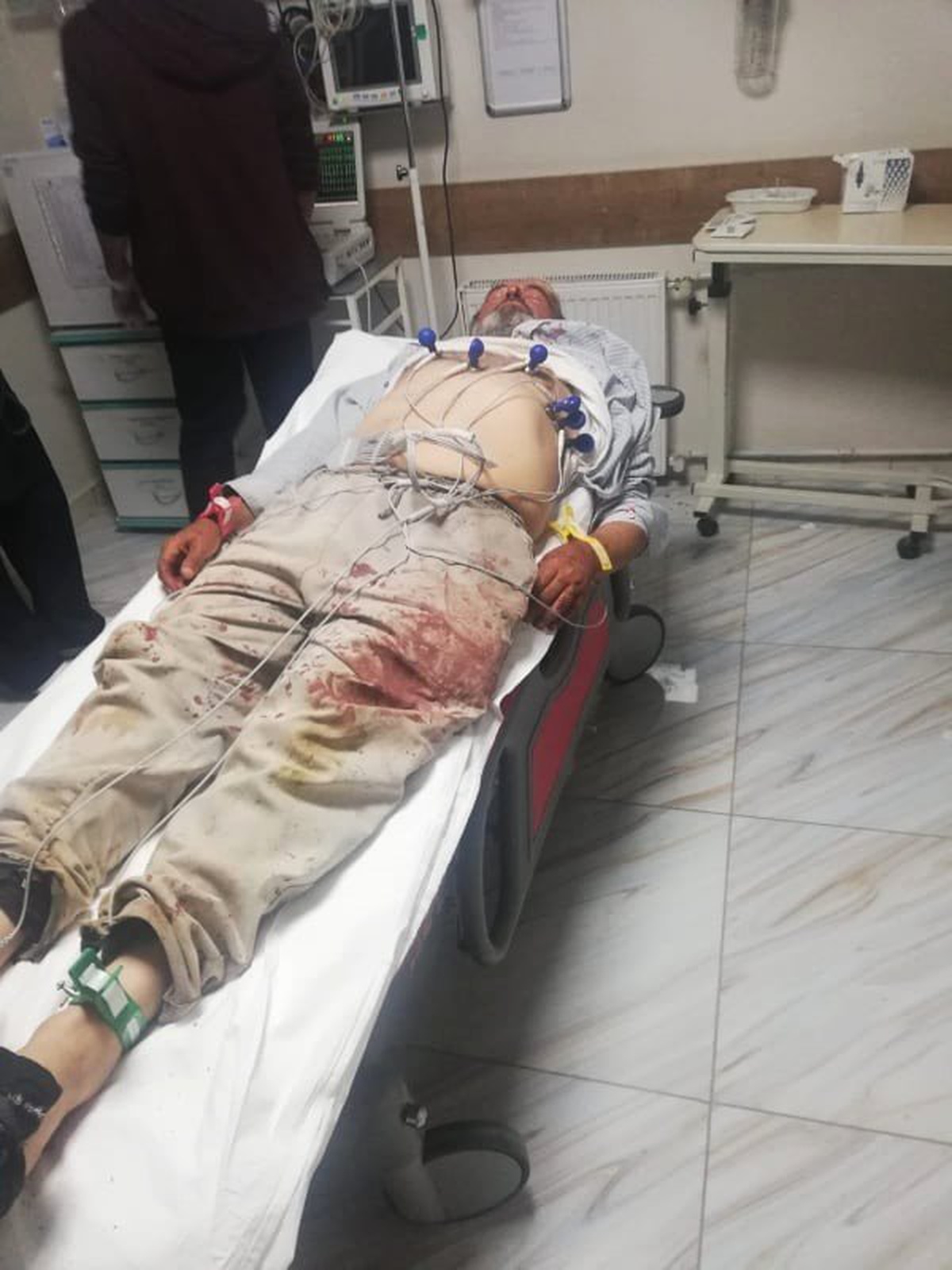 Karaman\'da Besicilerin Mera Kavgası Kanlı Bitti: 4 Yaralı