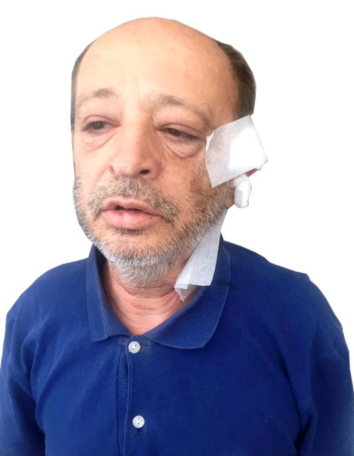 \'İspiyonculuğun sonu budur\' diyerek arkadaşının kulağını kesti