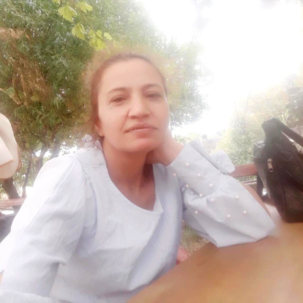 Evli koca, eski eşinin yüzüne kezzap attı