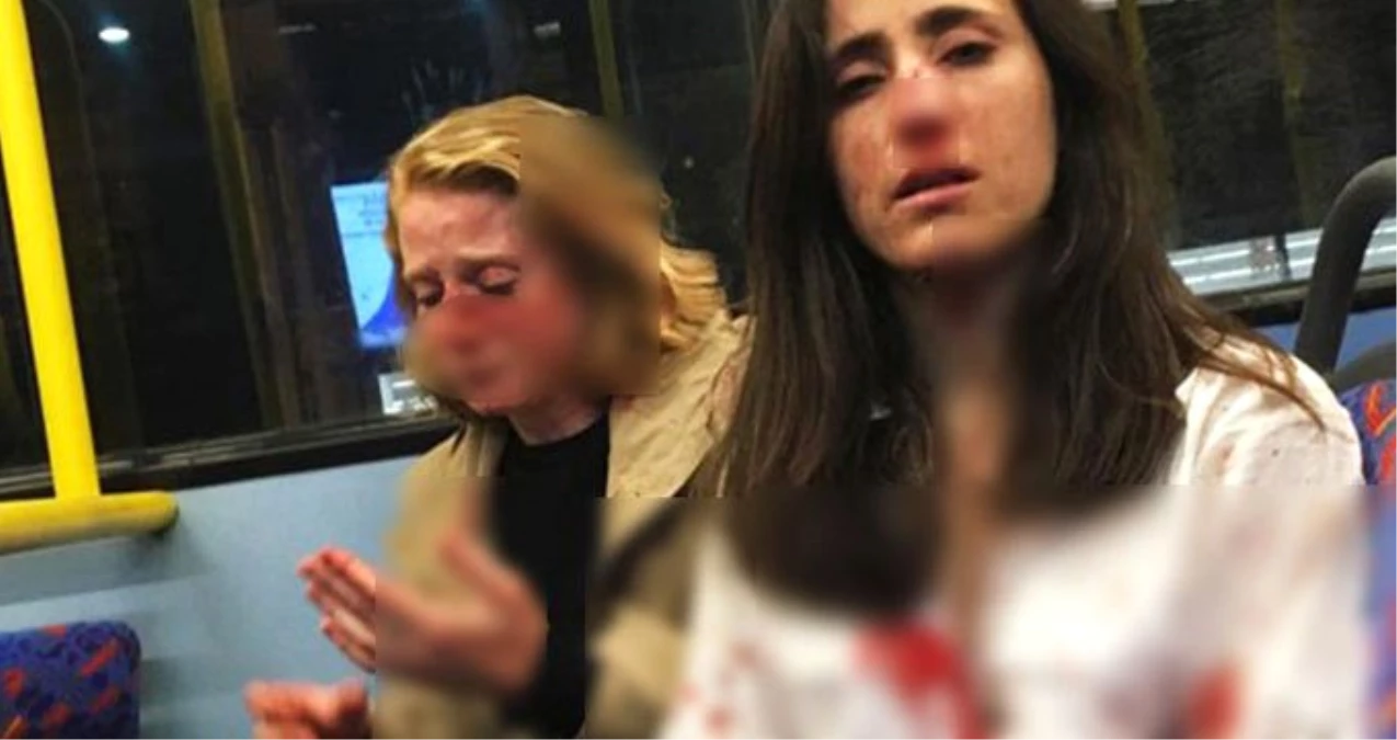 Londra\'da lezbiyen çifte saldıran dört genç gözaltına alındı