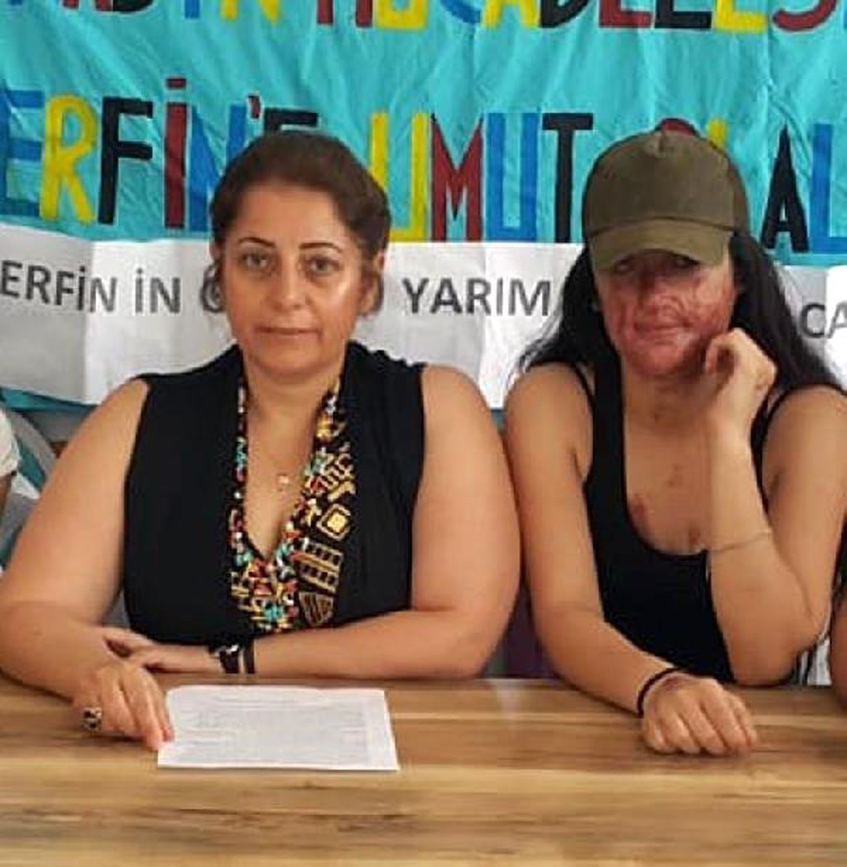 Asitli saldırıya uğrayan Berfin, 17 Haziran\'da ameliyat olacak